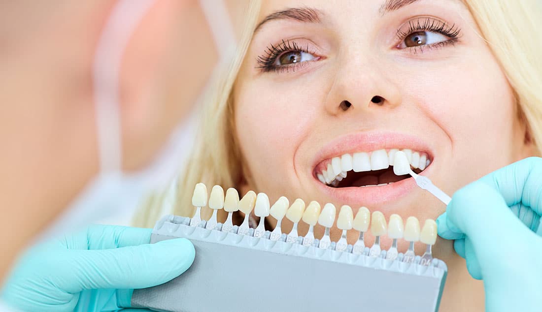 professional teeth whitening treatment in Melbourne, VIC
