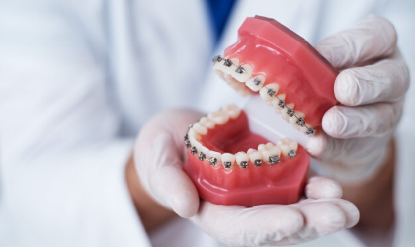 teeth-straightening-with-orthodontic-treatment